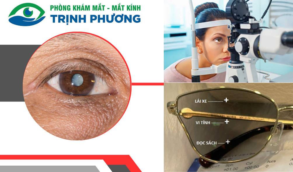 Phòng khám mắt Dĩ An