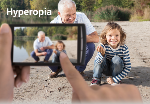 Sự Khác Nhau Giữa Viễn Thị Và Lão Thị: Nguyên Nhân, Triệu Chứng Và Cách Điều Trị