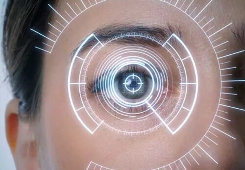 PHAKIC ICL 👉 CỨU CÁNH CHO TEAM CẬN – LOẠN NẶNG, GIÁC MẠC MỎNG