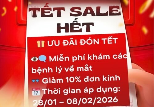 TẾT ĐẾN – MẮT XINH – DIỆN MẠO MỚI