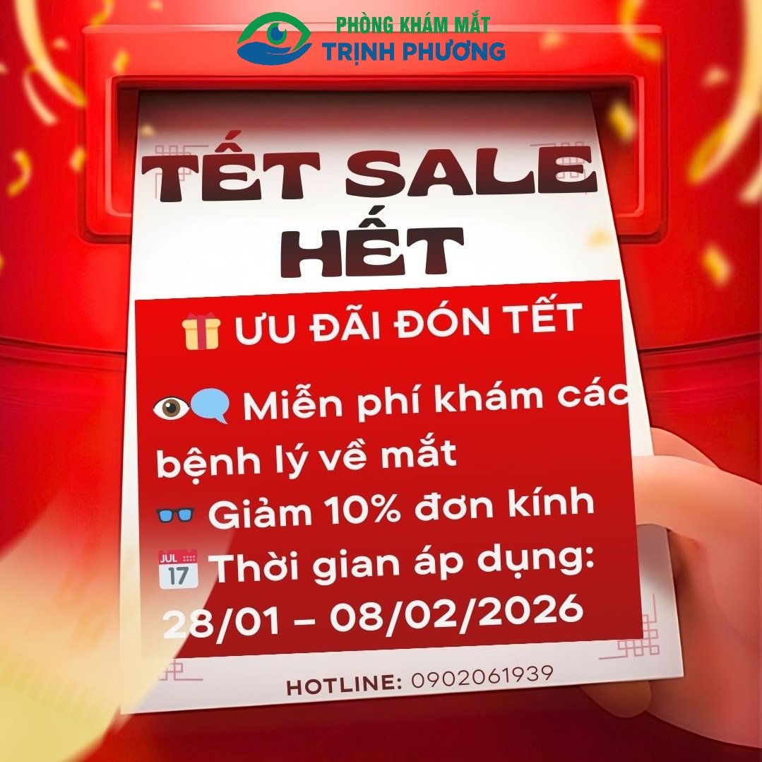 TẾT ĐẾN – MẮT XINH – DIỆN MẠO MỚI