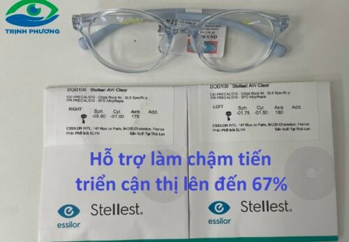 TRÒNG KÍNH ESSILOR STELLEST™ – GIẢI PHÁP LÀM CHẬM TIẾN TRIỂN CẬN THỊ ĐẾN 67% CHO TRẺ EM