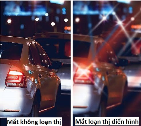 👀 “LOẠN THỊ” KHÔNG PHẢI LÀ MẮT LÚC RÕ, LÚC MỜ! 😵💫